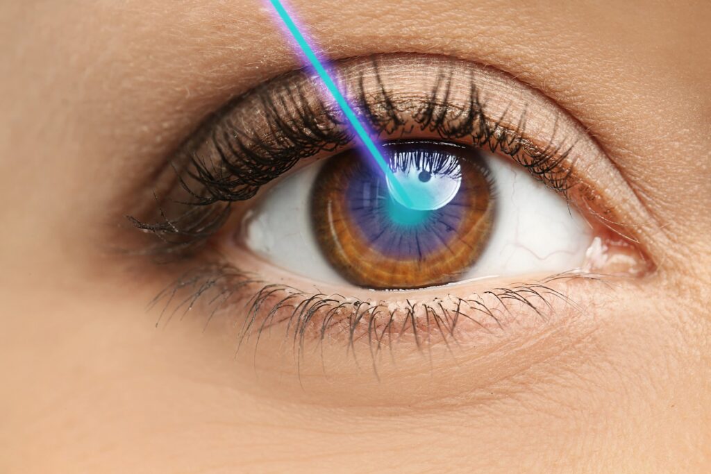 Sides effects of laser eye surgery explained